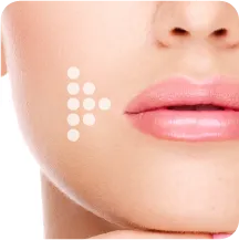 Periorbital wrinkles and lip lines